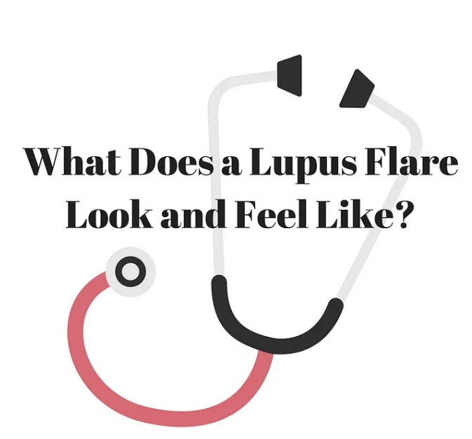 Lupus flare